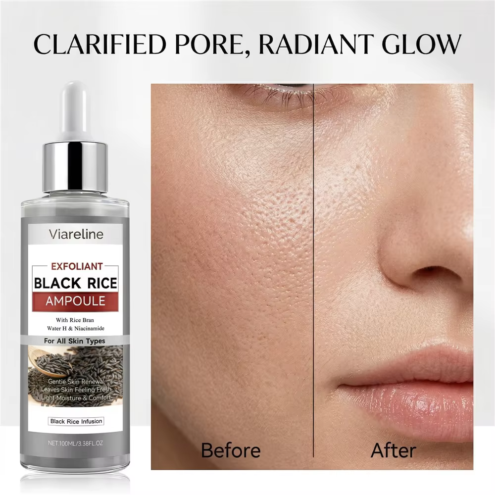 Sérum exfoliant au riz noir, solution nettoyante et exfoliante pour le visage, minimiseur de pores, 