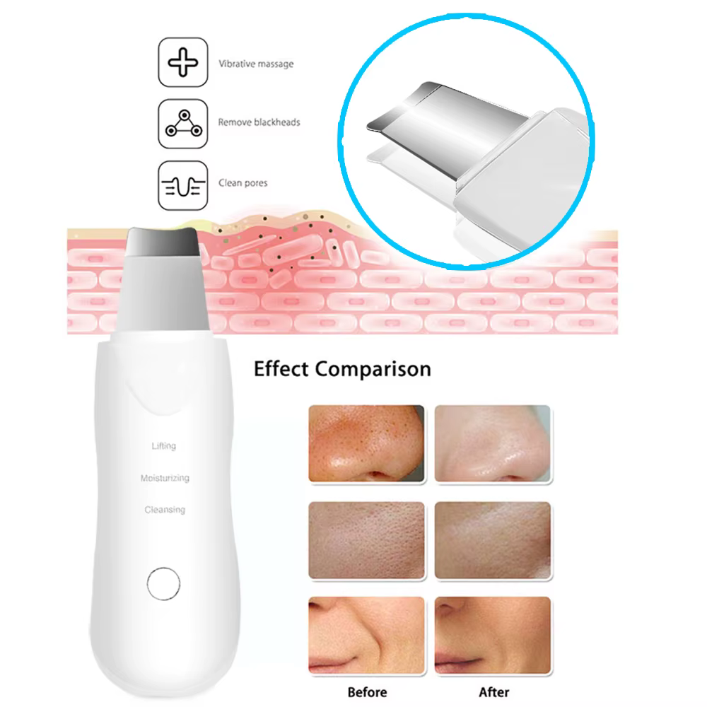 Épurateur de peau à ultrasons à vibrations profondes, nettoyeur de visage, masseur facial, exfoliant