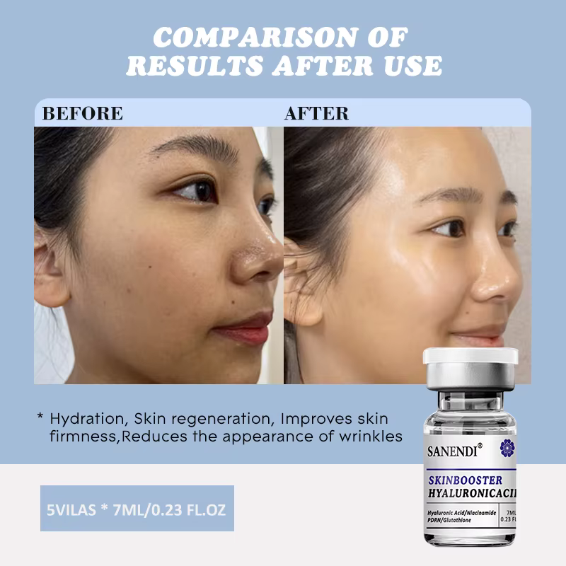Sanendi peau BOOSTER acide hyaluronique Solution de problèmes de peau du visage hydratant hydratatio