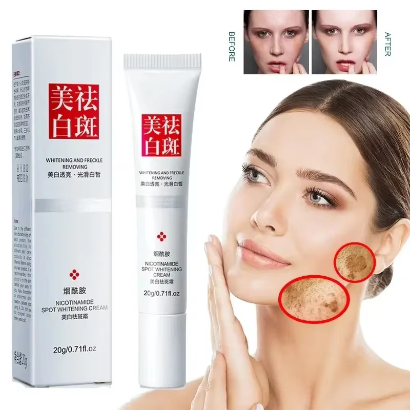 Crème blanchissante à la niacinamide pour le visage, estompe les taches de rousseur et les taches fo