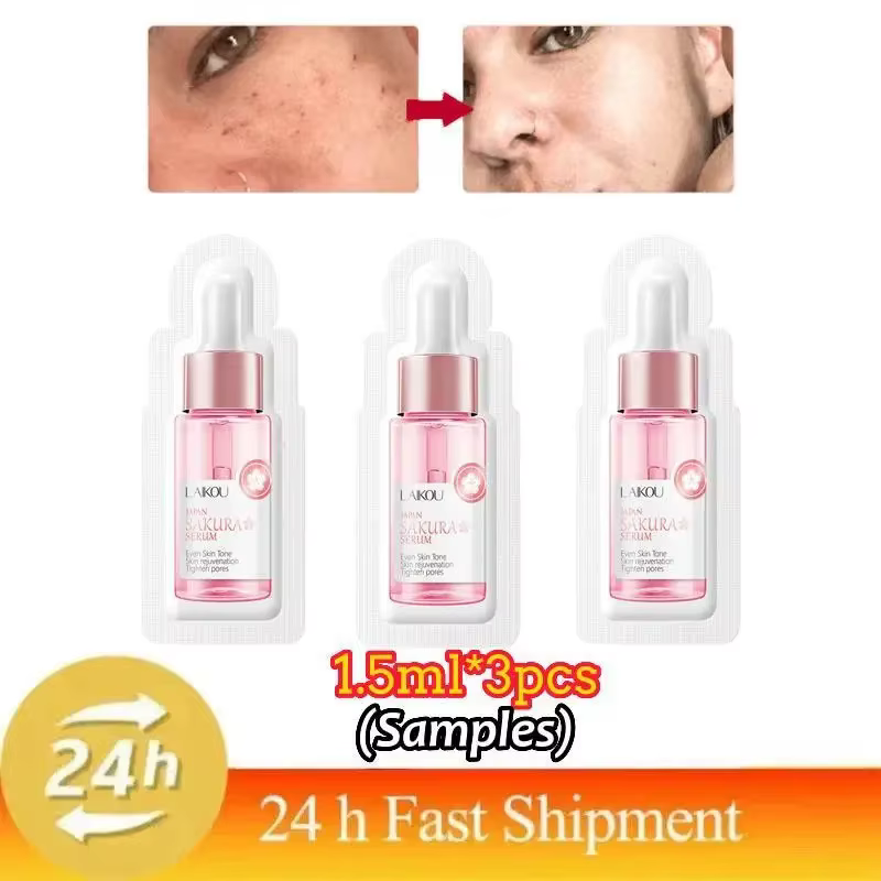 Sérum à la vitamine B3, estompe les taches foncées, cloasma, éclaircit la mélanine, Pigmentation des