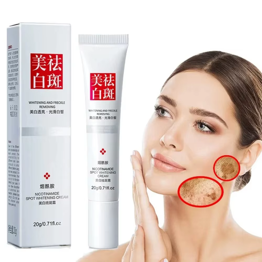 Crème pour le visage, estompe les taches de rousseur, taches foncées, Niacinamide, crème blanchissan
