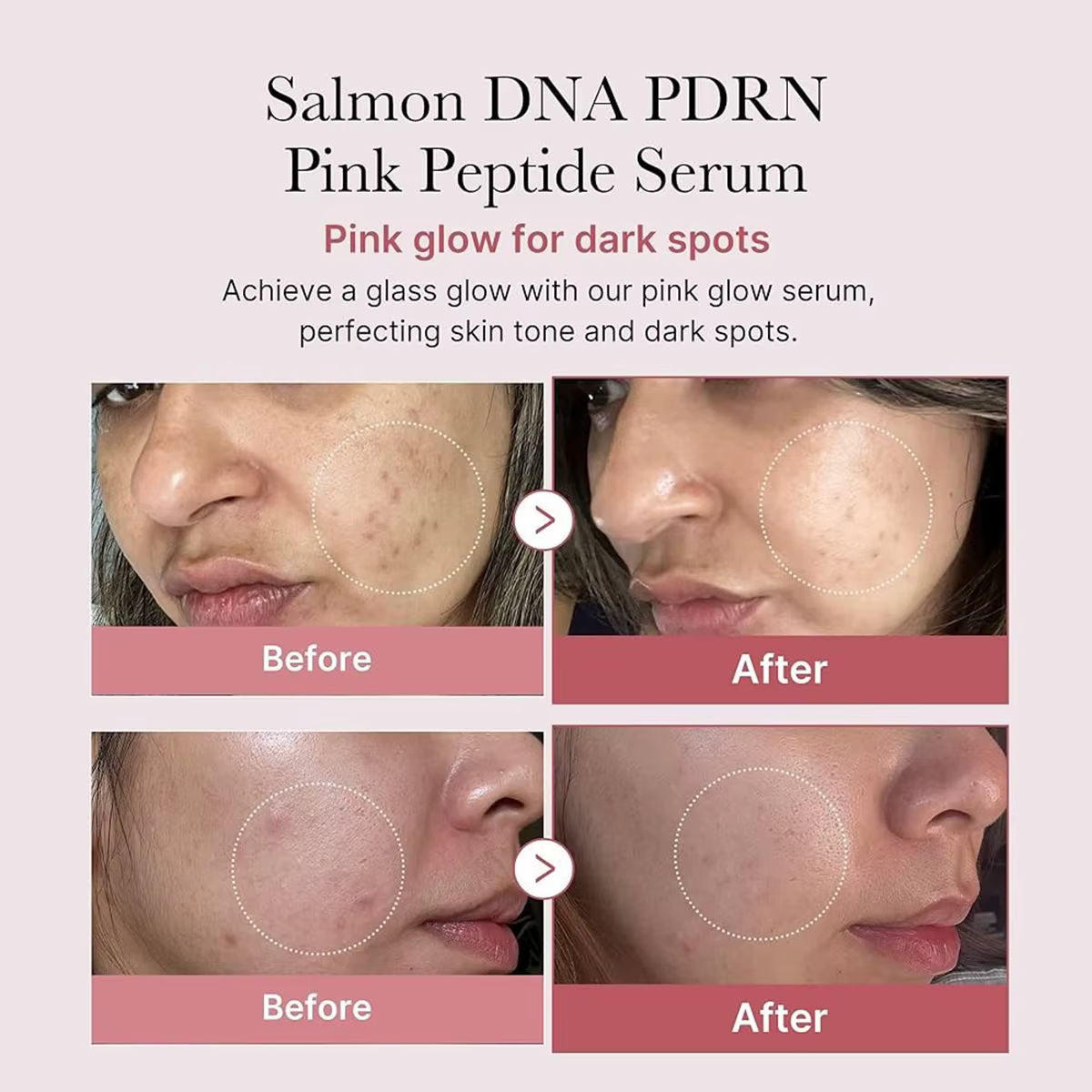 Sérum peptidique rose Medicube Salmon DNA PDRN, Texture sérum, ingrédients réparateurs complexes, Li