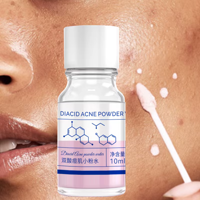 Essence d'acné concentrée d'acide salicylique rose de 10 ml - contenant d'acide salicylique, d'acide