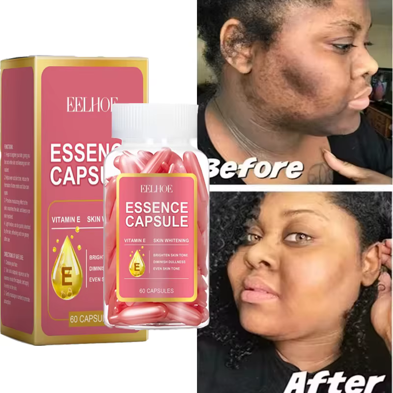 Capsule dissolvant de taches foncées de vitamine E ﻿ Visage taches de rousseur mélanine correcte Ant