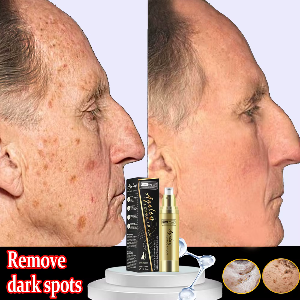 Flow-du-- Crème pour le visage raffermissante au rétinol, Essence anti-âge, Élimine les tâches brune