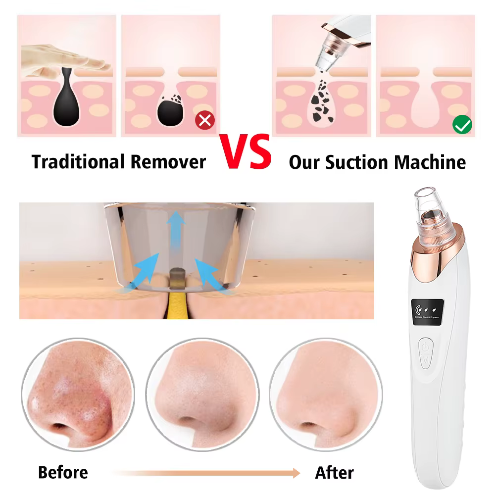 Dissolvant de points noirs pour le nettoyage du visage, machine de beauté à 3 modes d'aspiration, di