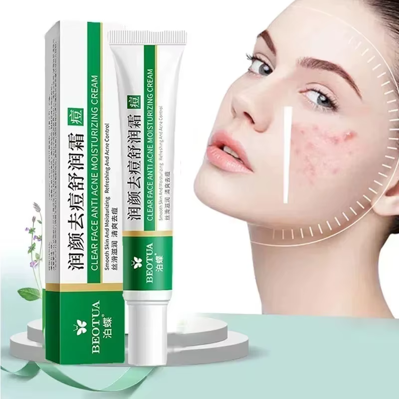 Crème de traitement de l'acné à base de plantes, dissolvant de cicatrices du visage, Gel réparateur,