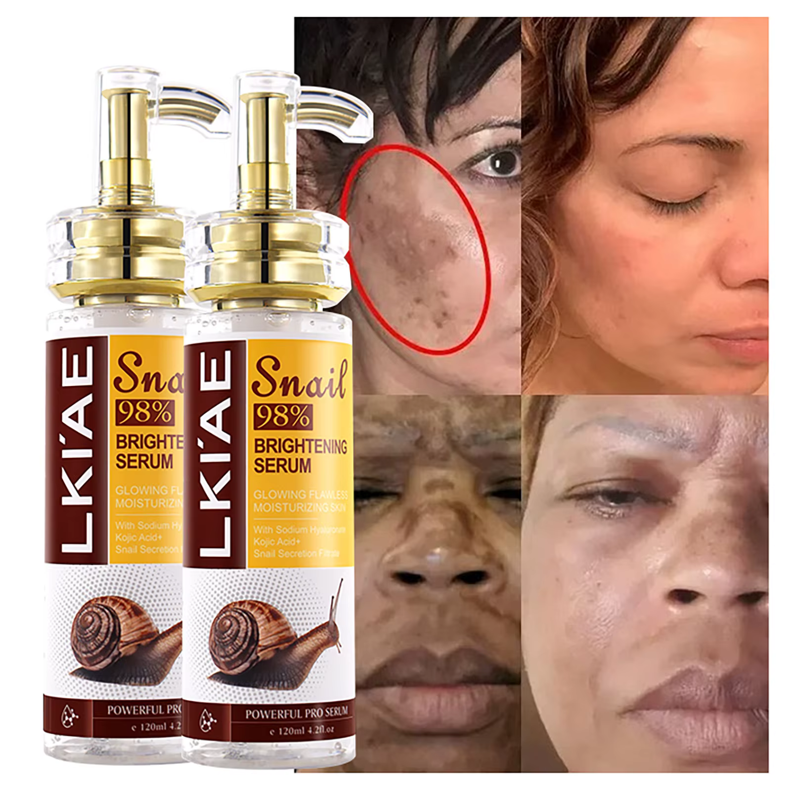 AILKE Sérum blanchissant à l'extrait d'escargot, hydratant, réduit les taches foncées, les rides, mê