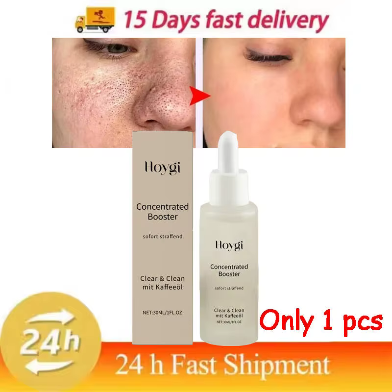 Sérum pour nettoyer les Pores du visage, délicat, tendre, hydratant, contrôle de l'huile, rétrécit l