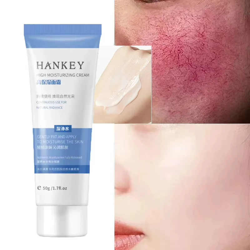 Crème réparatrice pour les rougeurs du visage, améliore la sécheresse de la peau sensible, hydratant