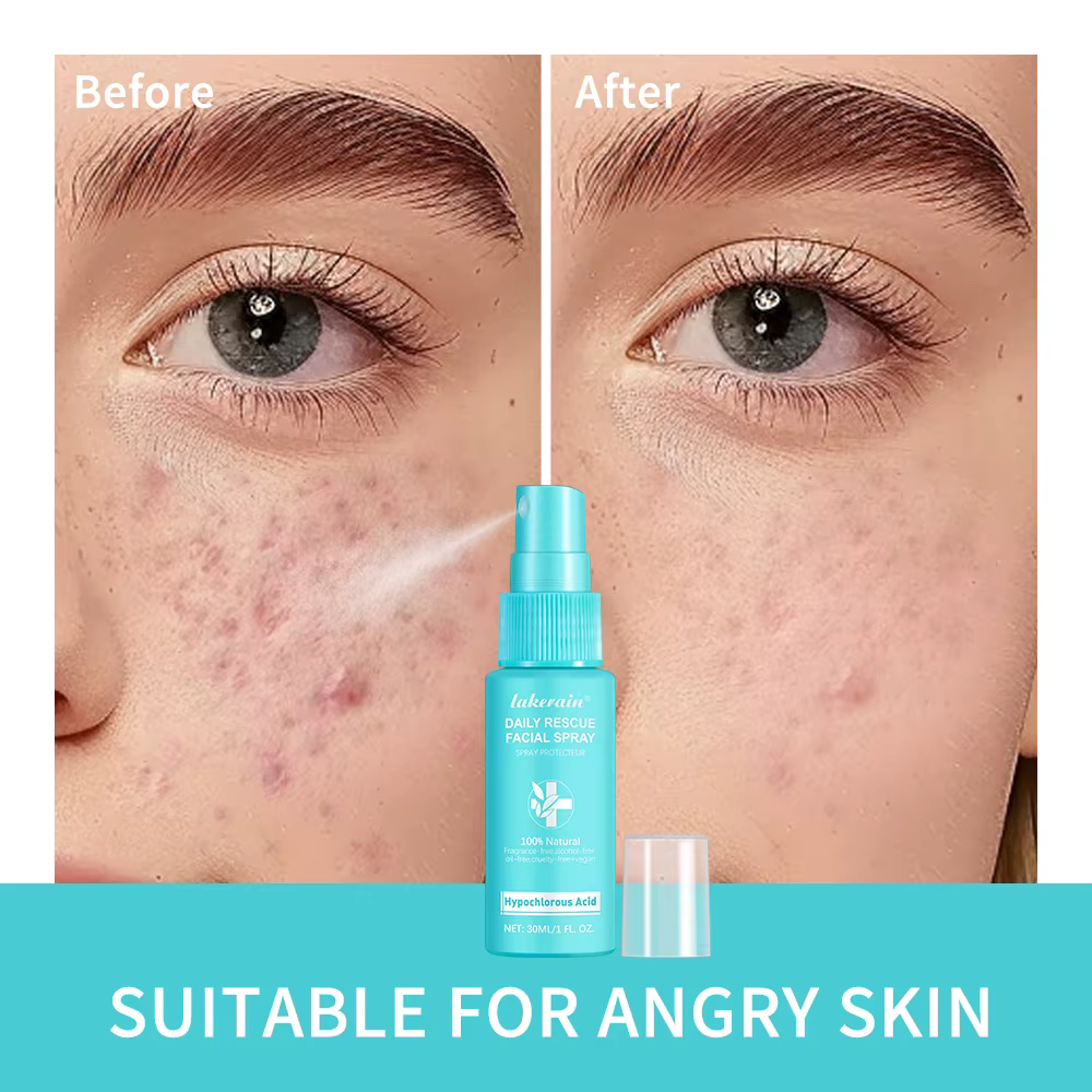 Spray d'acide hypochloreux pour la peau sensible, tonification des rougeurs, soins de la peau, canto
