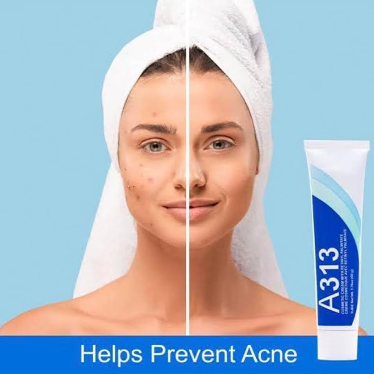 Crème au rétinol à la vitamine A A313 Resserre, soulever, adoucit et hydrate la peau, hydratant pour