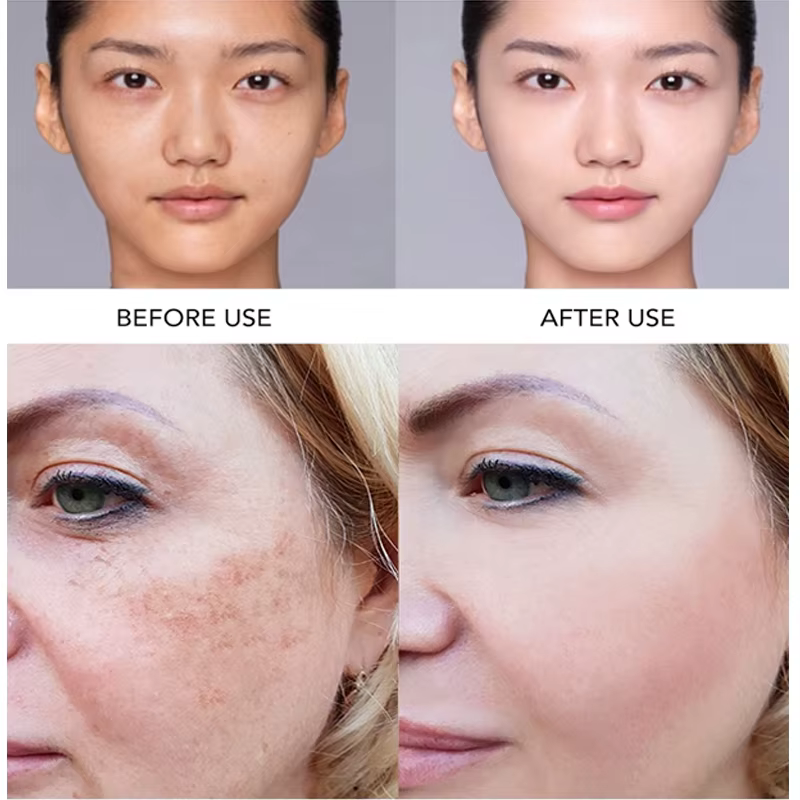 AILKE Sérum éclaircissant supérieur pour le visage