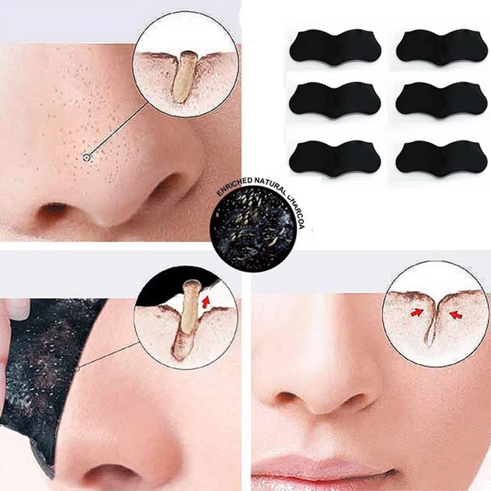 Nez points noirs dissolvant masque bandes nasales tête noire nez