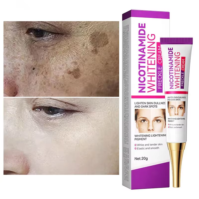 Crème éclaircissante au Melasma Niacinamide douce