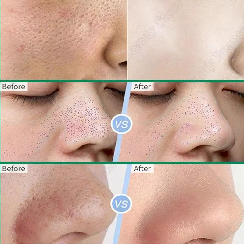 Crème de nettoyage des pores à l'acide salicVAC