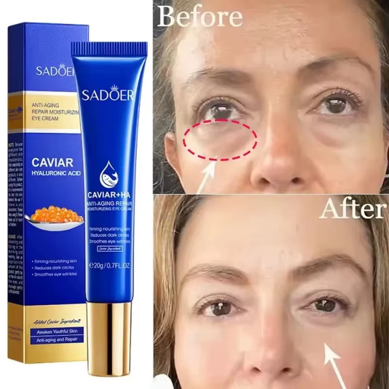 Crème anti-caviar pour les yeux
