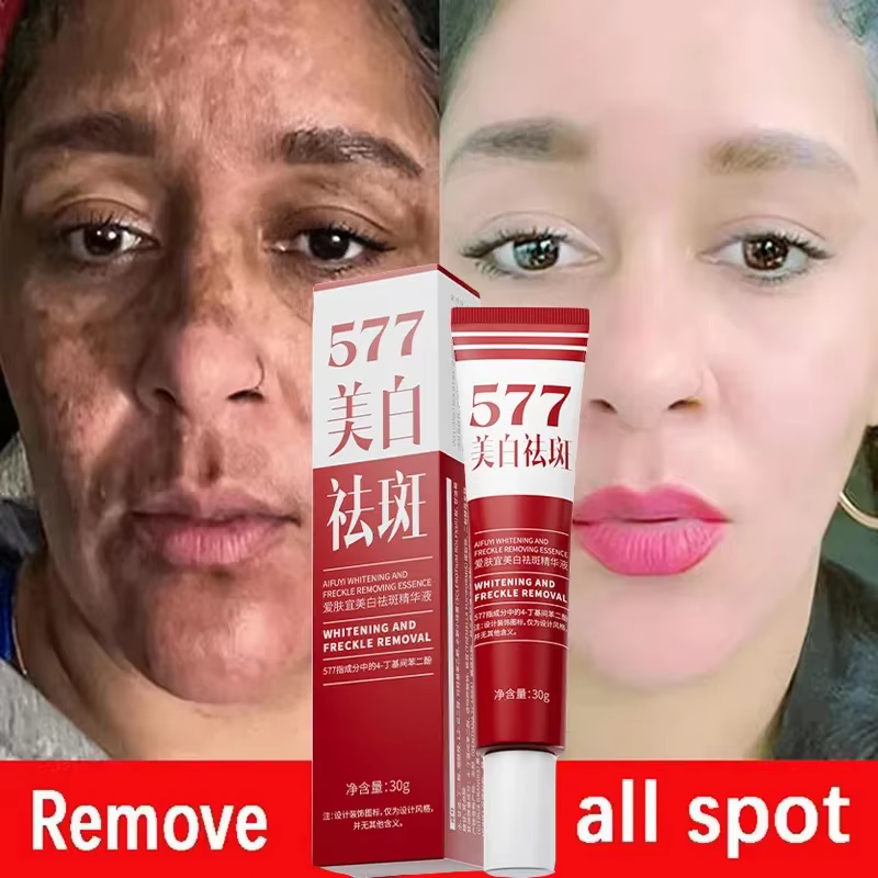 Crème blanchissante pour le visage