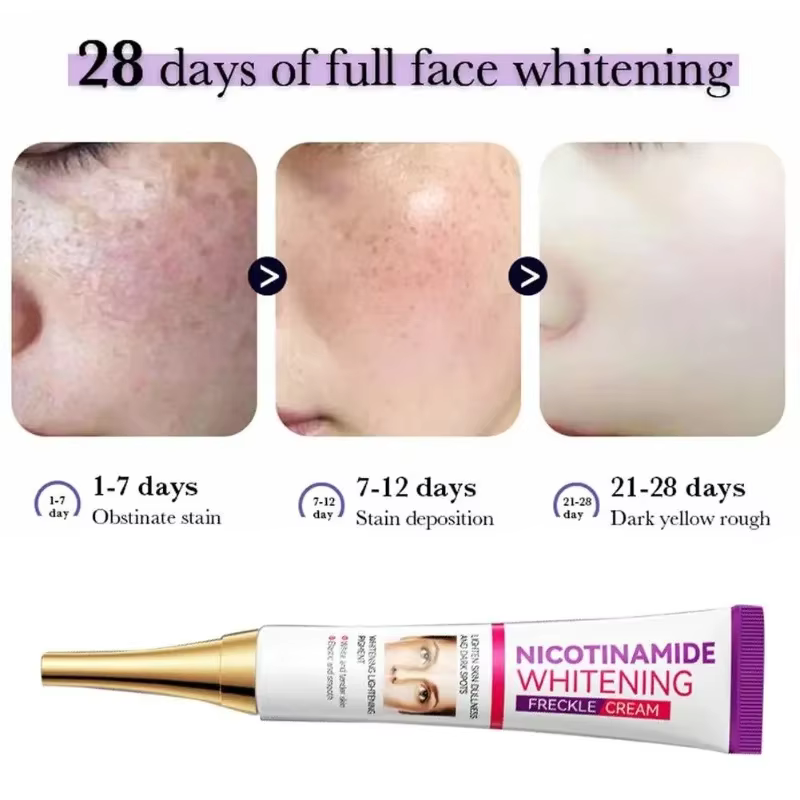 Crème éclaircissante au Melasma Niacinamide douce