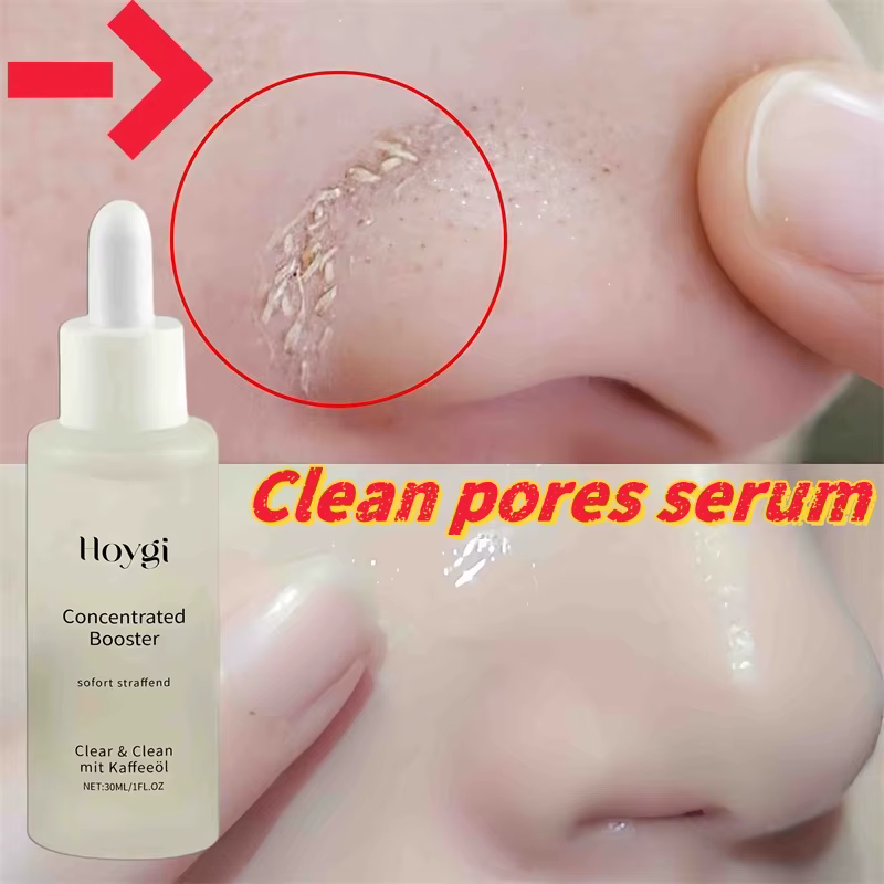 Sérum pour nettoyer les Pores du visage