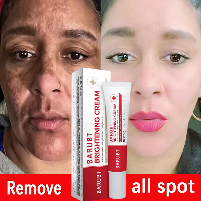 Crème blanchissante pour le visage