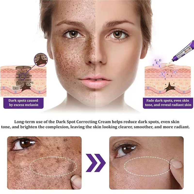 Crème éclaircissante pour le visage