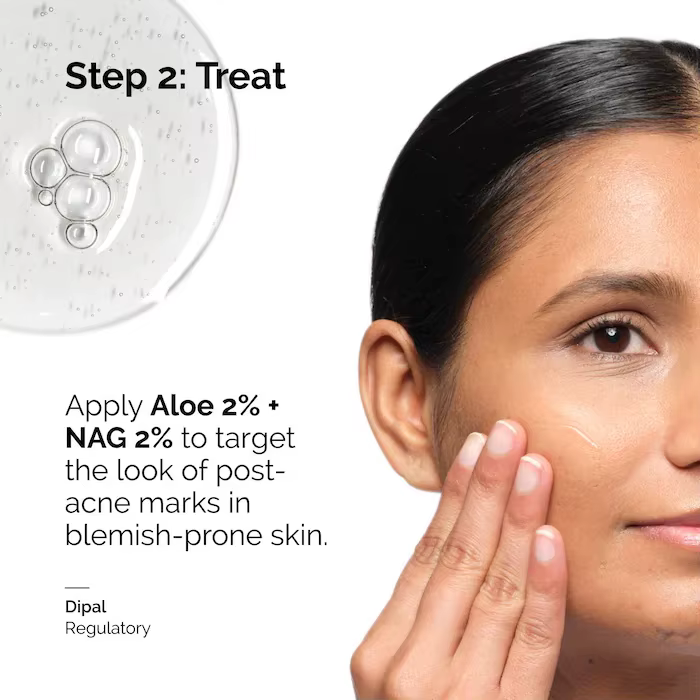 Sérum Solution Aloe 2% + NAG 2% 30 ml pour les marques post-acné améliore la texture de la peau