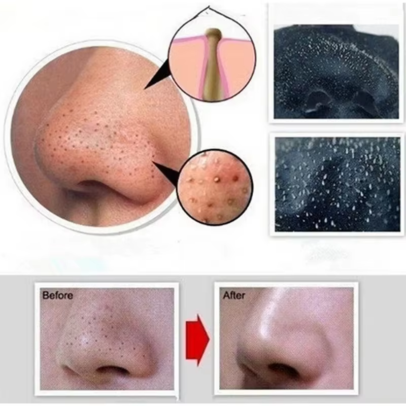 Masque anti-points noirs au charbon de bambou