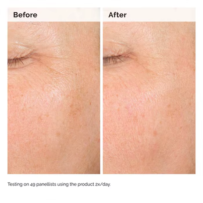 Alpha Arbutin 2% + HA 30ml Sérum Minimise L'apparence des Taches Foncés et Décoloration Hydrate La Peau