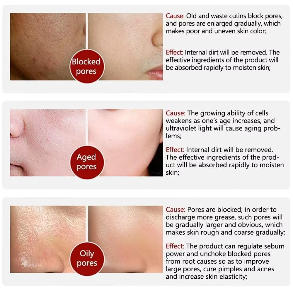 Skin Bergamo | Pore Refining Resurfacing