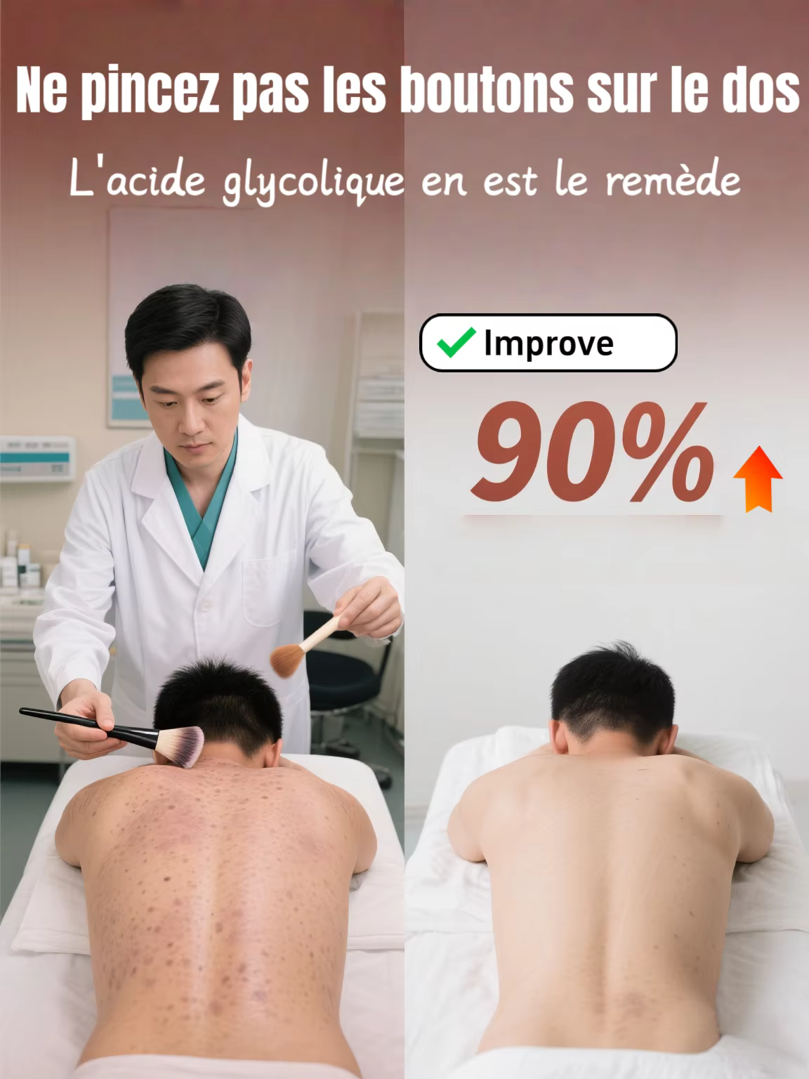 Peeling chimique à l'acide glycolique