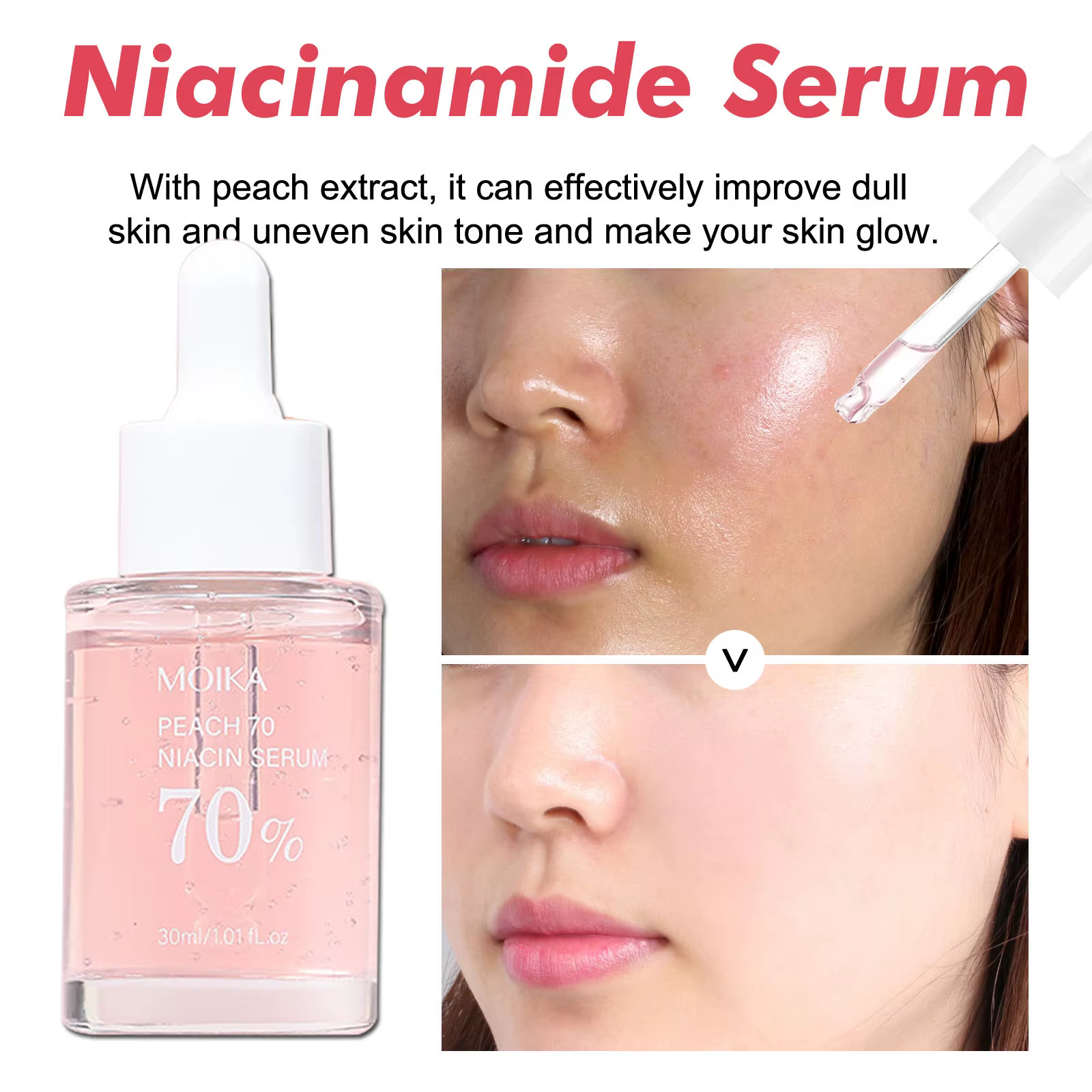 Sérum Niacinamide en élimination de la mélanine