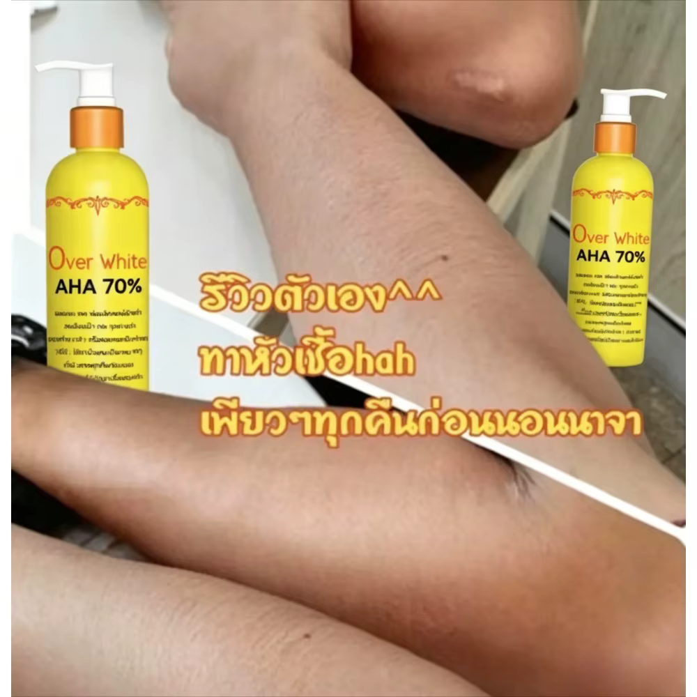 Sérum éclaircissant pour le corps AHA 70% - Élimine les taches sombres - Blanchiment - 120ml