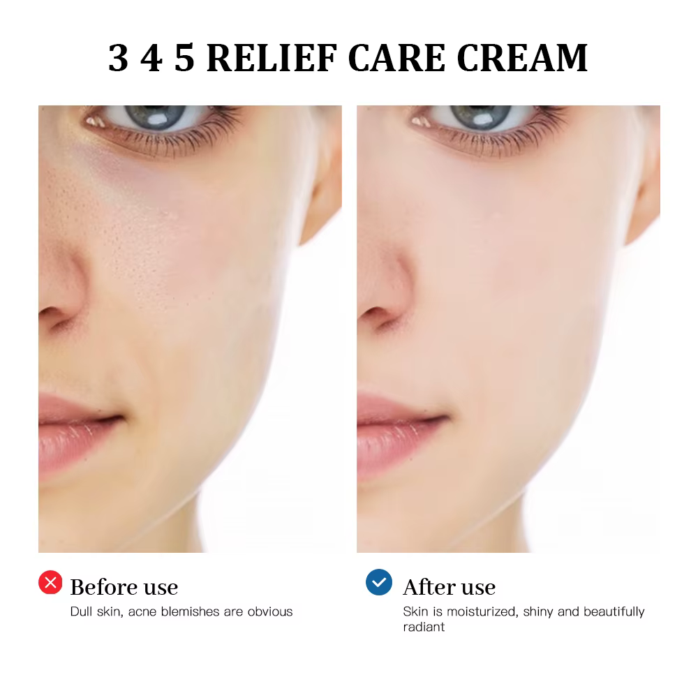Solution de crème de soulagement pour les problèmes de peau