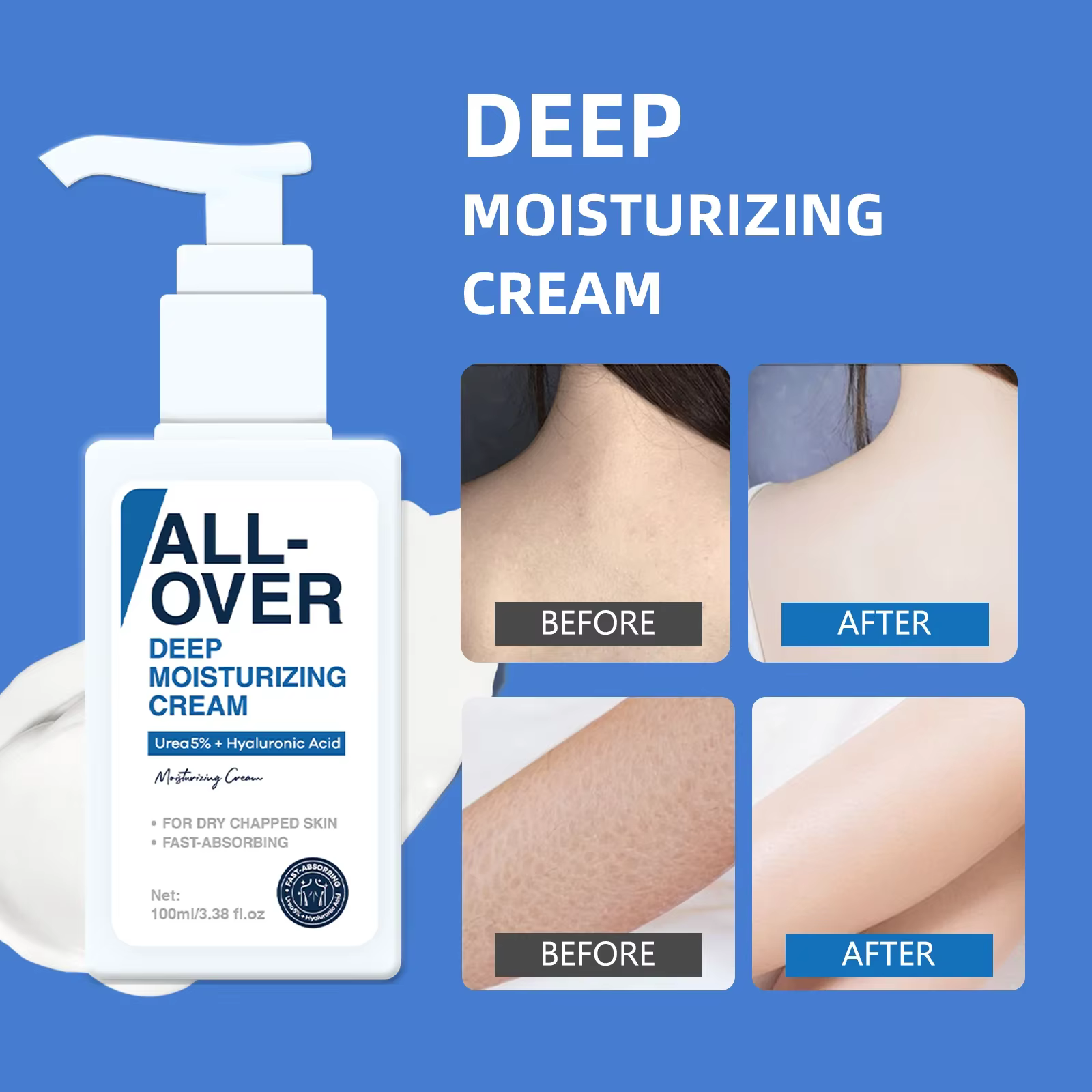 ALL-OVER crème hydratante en profondeur 100ml 5% urée acide hyaluronique hydratation peau sèche gercée Absorption rapide visage corps soins des mains