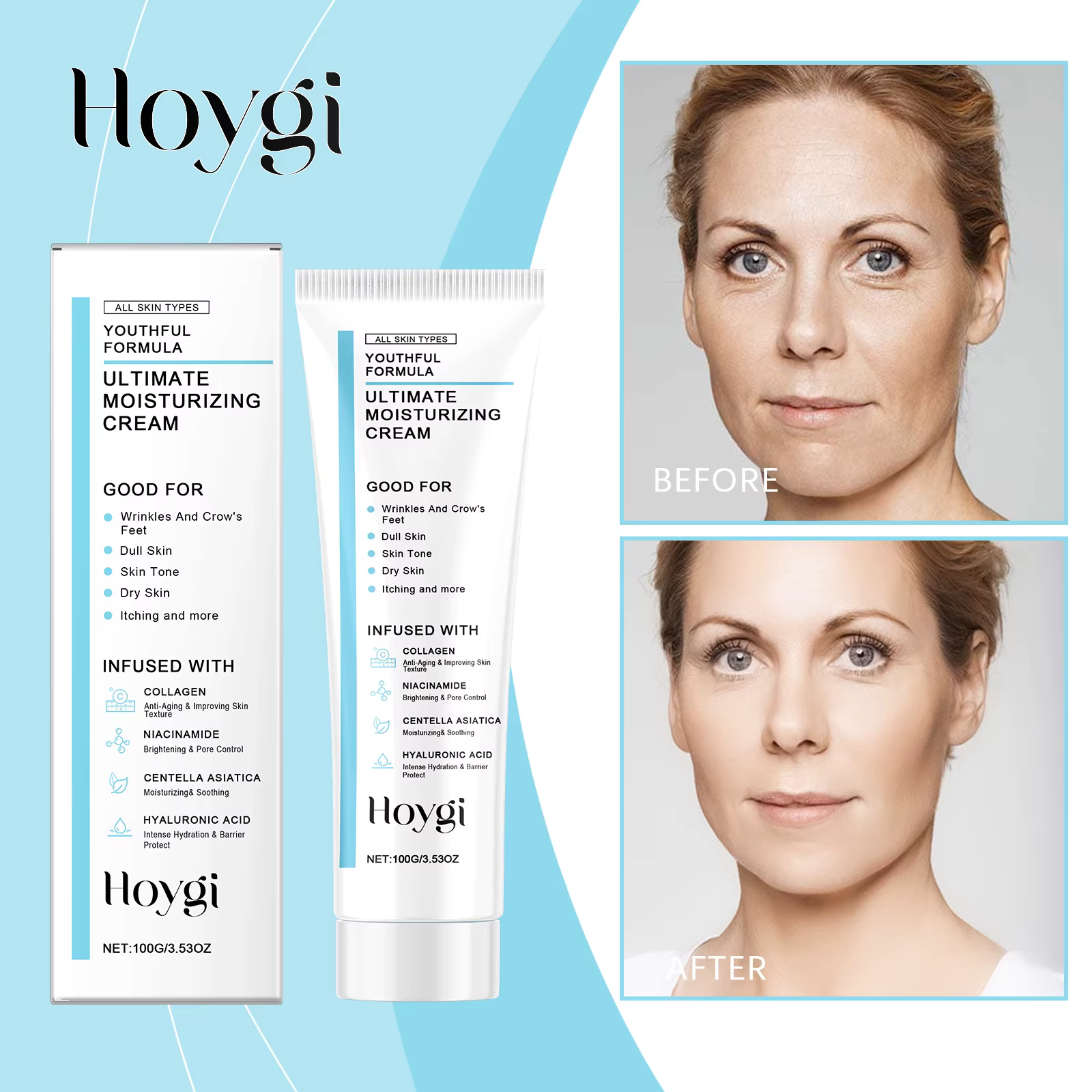 Hoygi Centella Asiatica Cica crème hydratante apaisante quotidienne pour peau sensible éclaircissante