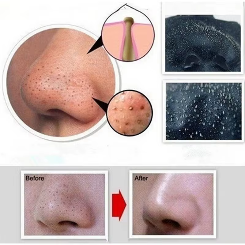 Masque anti-points noirs