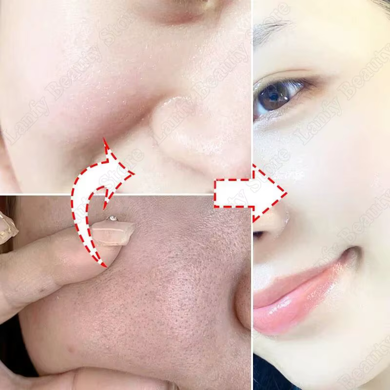 Crème de nettoyage des pores à l'acide salicVAC