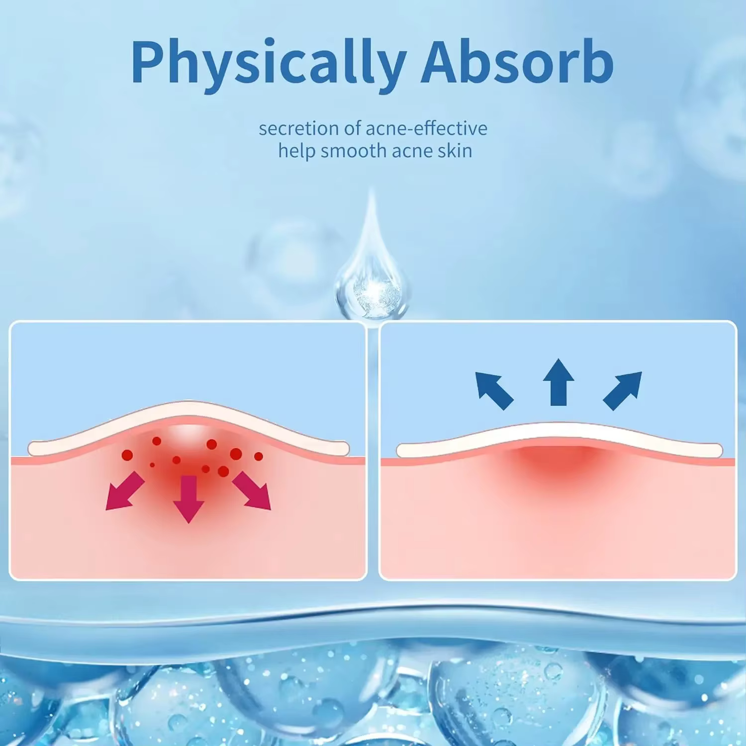 Autocollants hydrocolloïdes contre l'acné