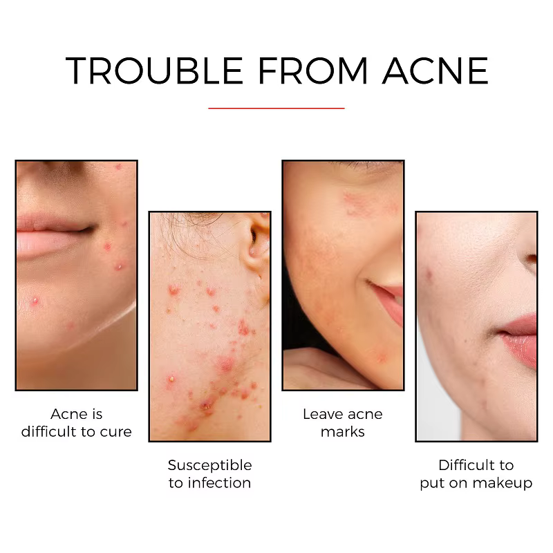 Autocollants de traitement pour le visage