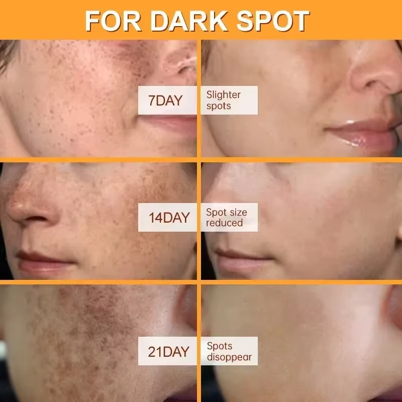 Crème blanchissante pour le visage