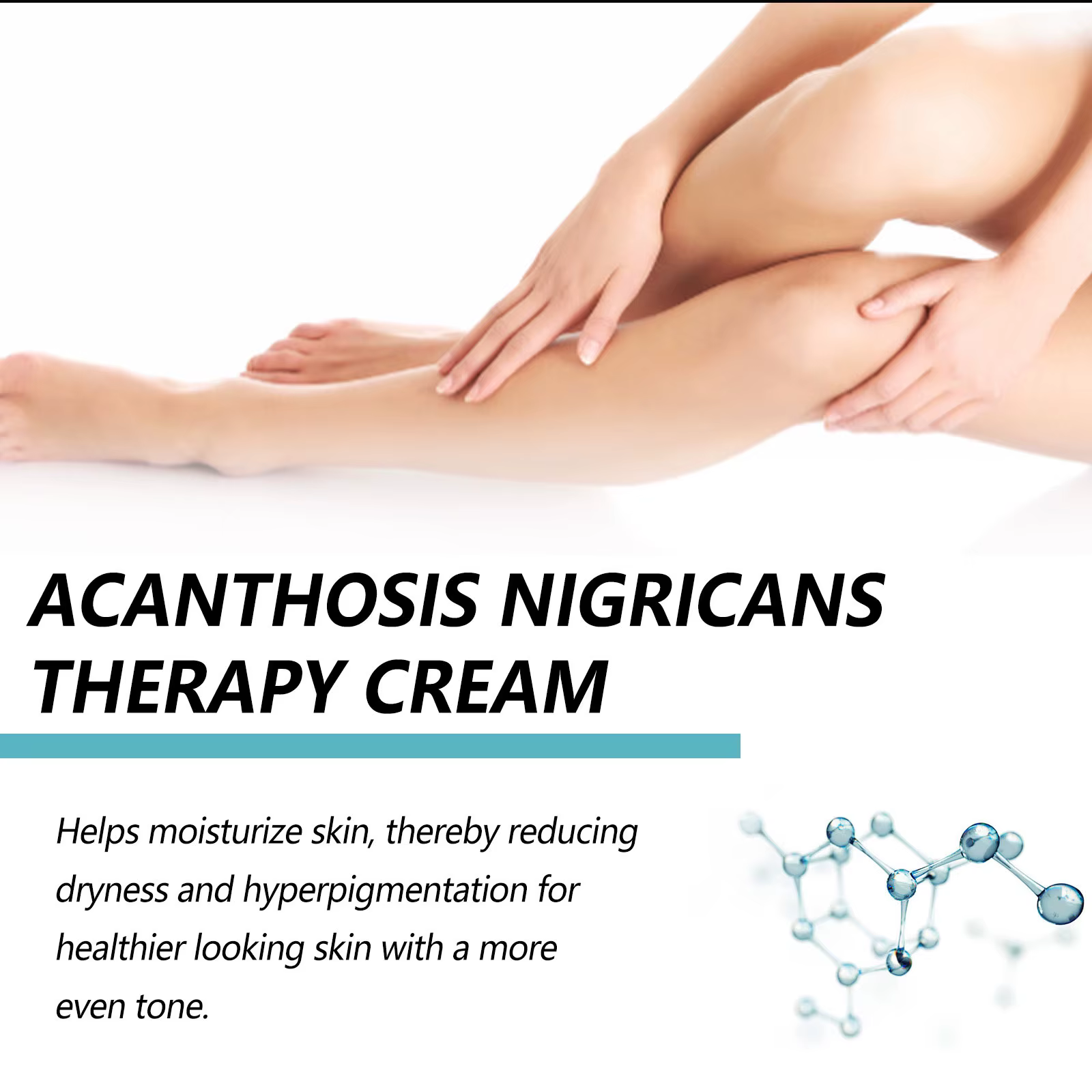 EELHOE acanthose Nigricans thérapie crème cou bras genou articulation aisselles éclaircissant produits de soins du corps