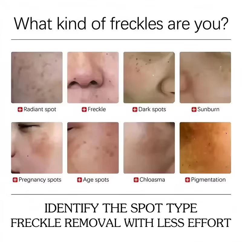 Crème éclaircissante pour le visage
