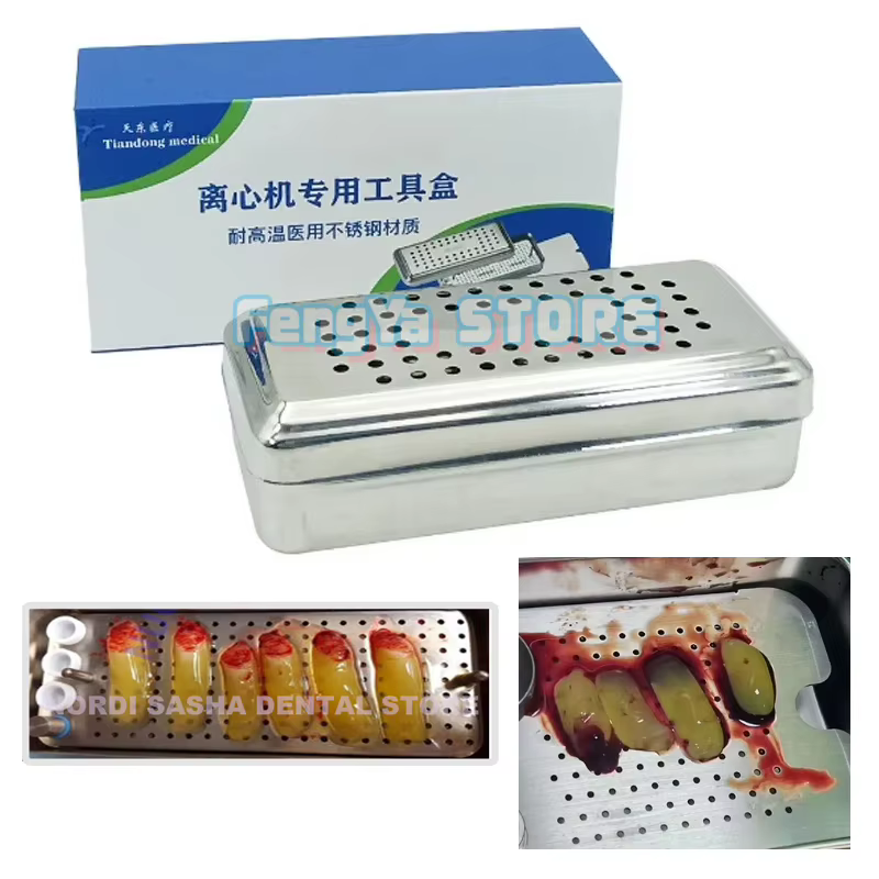 1 Ensemble de Boîtes PRF GRF Dentaires en Acier Inoxydable pour Plaques d'Implants, Boîte de Fibrine Riche, Boîte PRF Odontologie, Boîte PRF pour Implants Dentaires