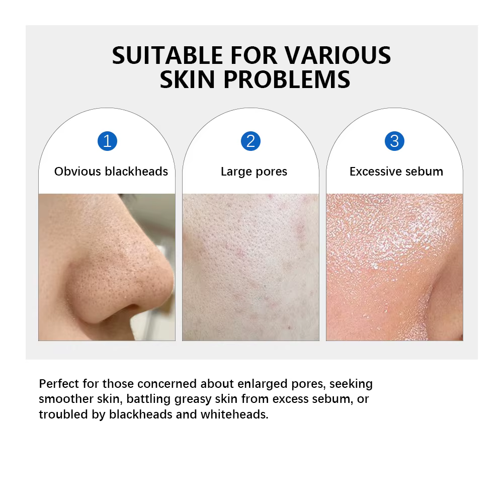 Coussinet pour pores zéro 2.0