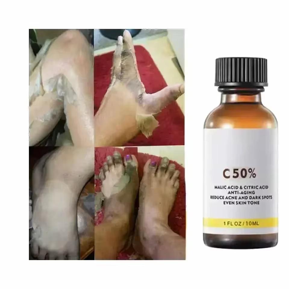 Mélanine de soins du visage pour une peau plus éclatante