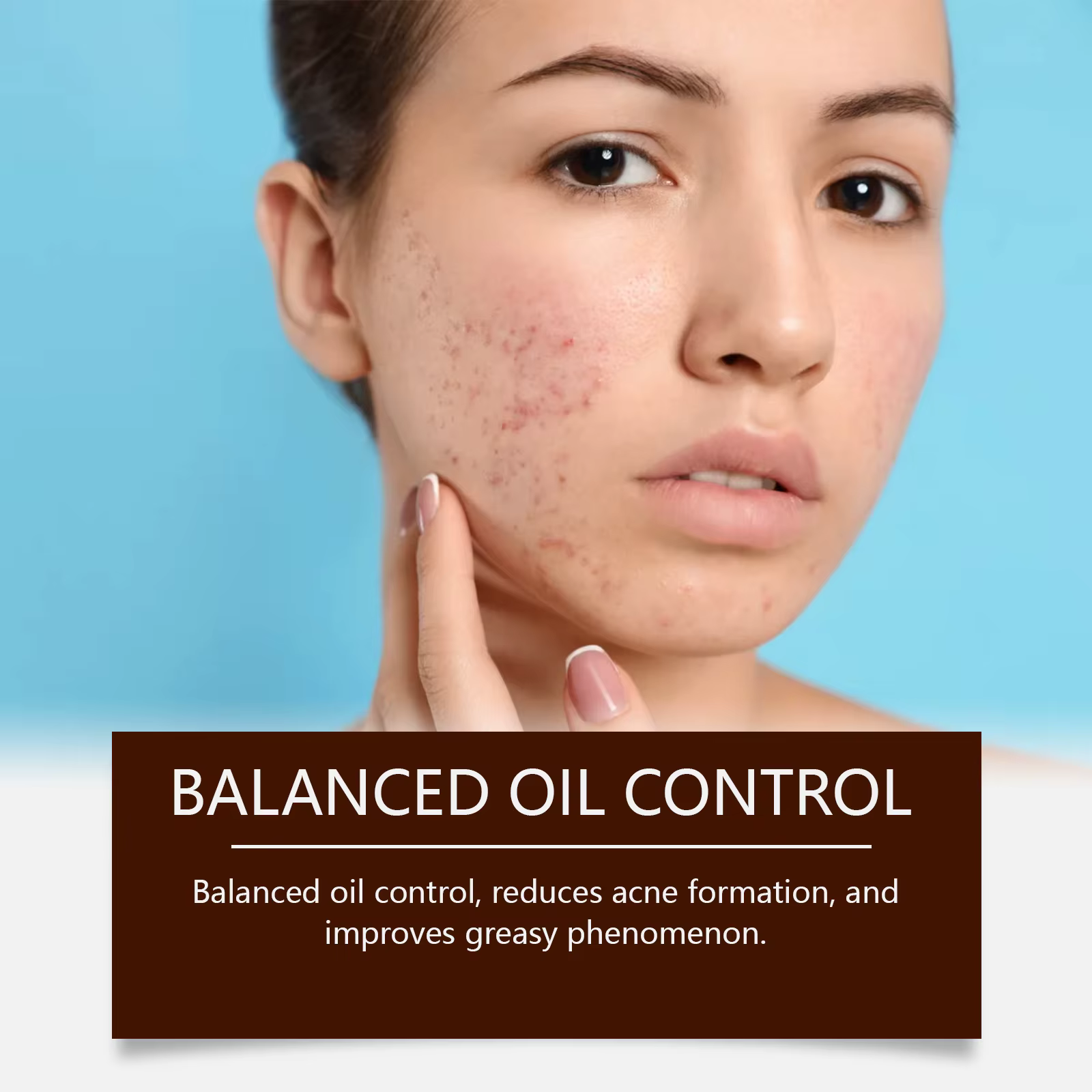 Crème de traitement de l'acné pour le visage
