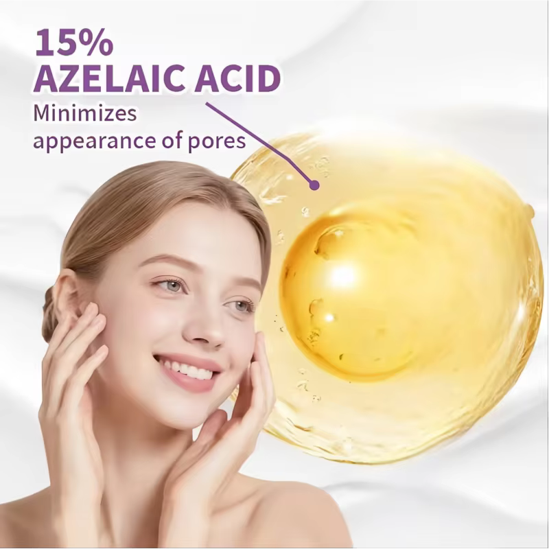 Crème pour le visage à 15 % d'acide azélaïque, essence hydratante en profondeur, absorption rapide, douce et respectueuse de la peau. Les ingrédients incluent de l'acide kojique, de la niacinamide, de