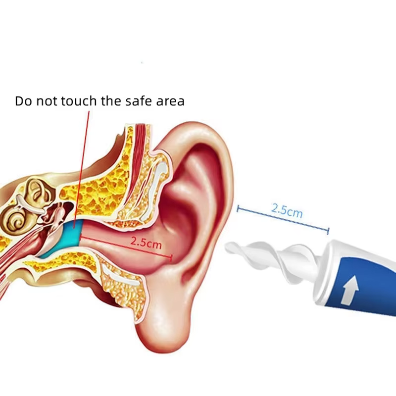 Nettoyeur d'oreilles en spirale, outil de retrait de cérumen avec 16 embouts de rechange en silicone souple, pour une extraction facile du cérumen, soin de nettoyage des oreilles